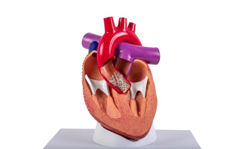 Cardiac,Model,Of,Transcatheter,Aortic,Valve,Implantation,(tavi),For,People