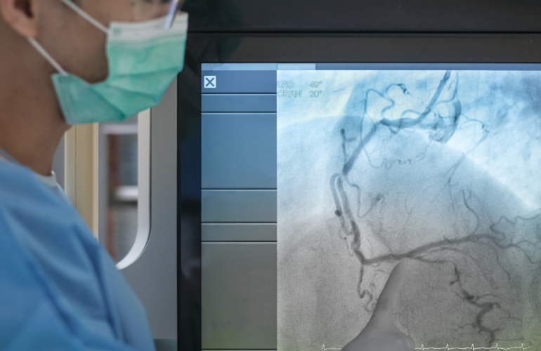 coronary angiography feature image