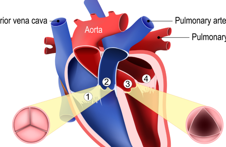 Heart Valve
