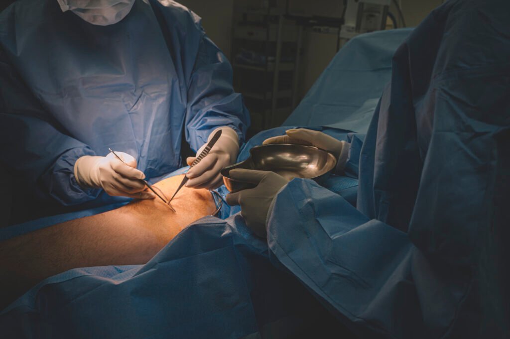 Best Vascular Surgeons in Malaysia