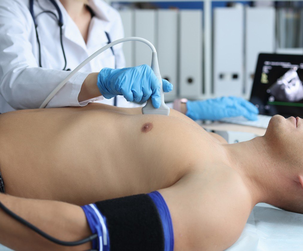 Understanding Acute Myocardial Infarction - Diagnosis