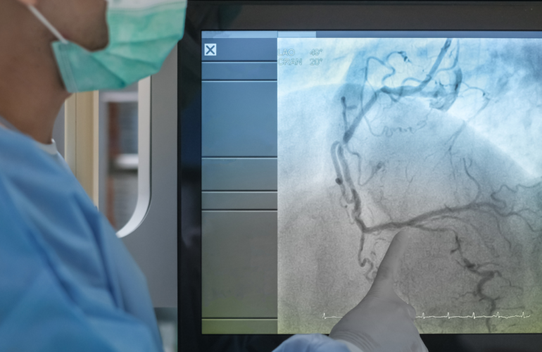 Vascular Screenings