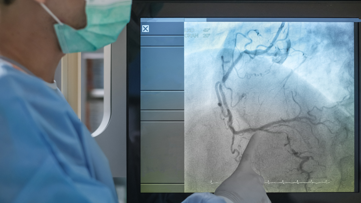 Vascular Screenings