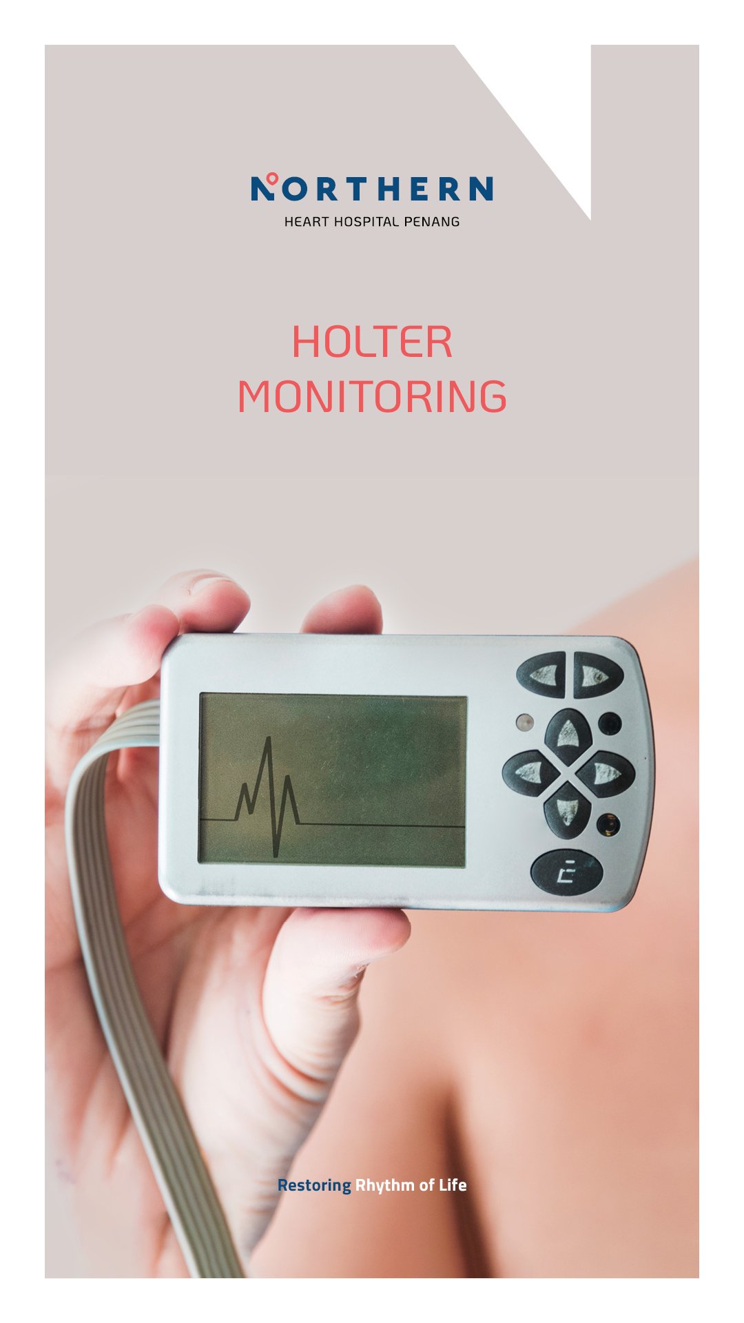 Holter Monitoring